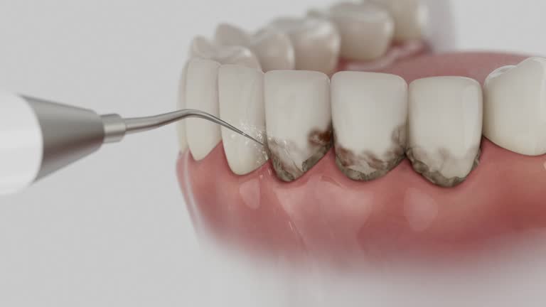 Reliable Dental Implants contractor in Hanover, MN by Smile Center Dentistry